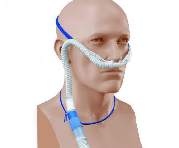 Cateter nasal de alto fluxo